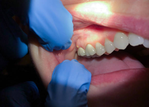 Best Weekend Emergency Dental Services in Massanetta Springs, VA